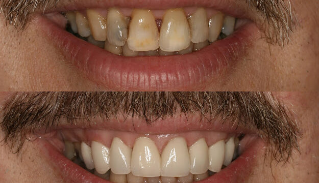 AF1QipM5ZevF1Q2-4VrJ3H35r4Ohn8bdWAcNSXduvq2Jw800-h500-k-no.jpg