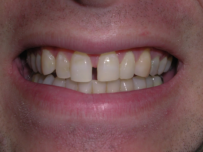 Central Park West Dental
