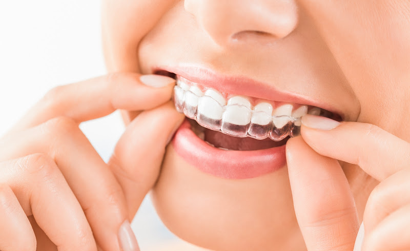 Artista Dental Studio, Dr. Joseph Manfredi DDS