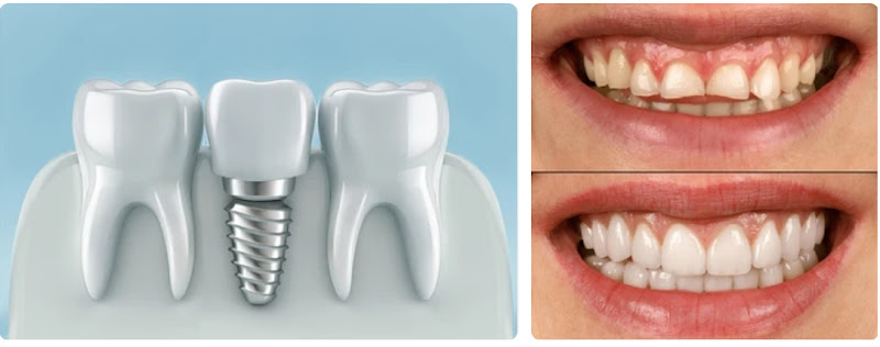 The Tribeca Dentist: Paolo Saggese, DMD, PLLC