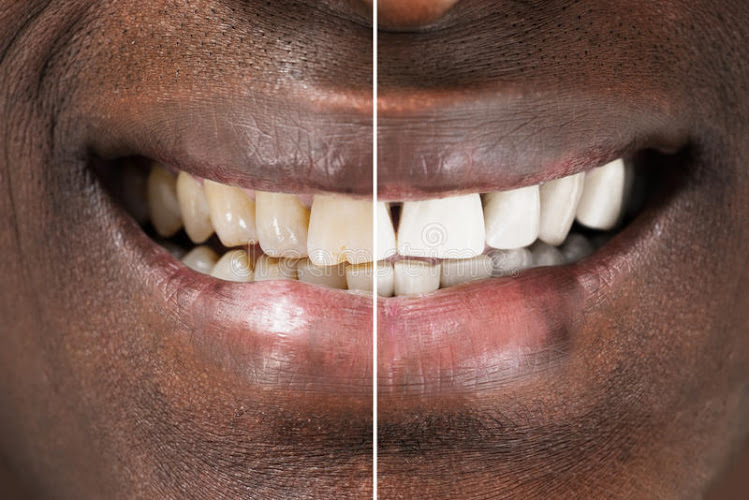 Jessica deSouza DDS JDental