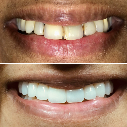 Advanced Dental Arts NYC – LANAP Specialist