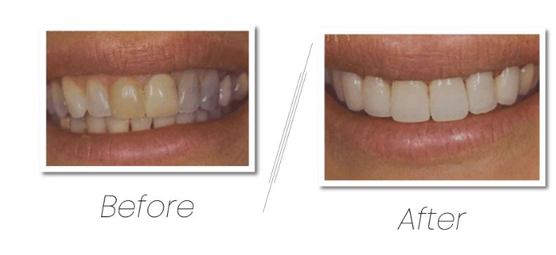 Gauri Savant, DDS