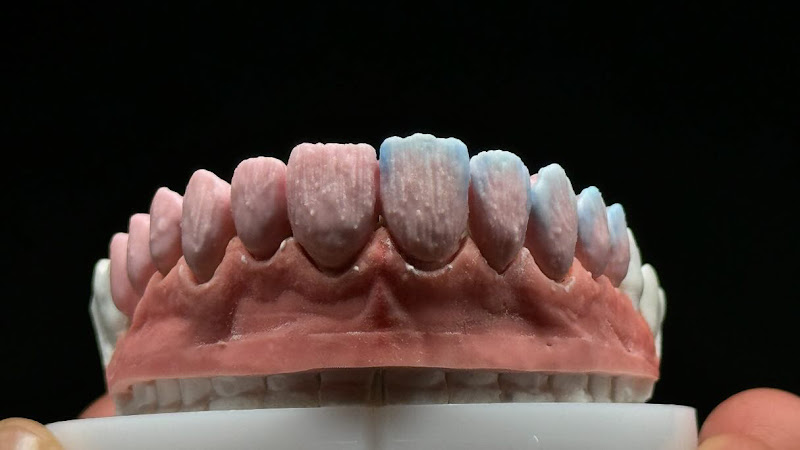 Manhattan Dental Design: Ernest Tchoi, DMD