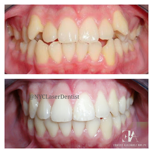 Edward A. Alvarez, DDS, PC
