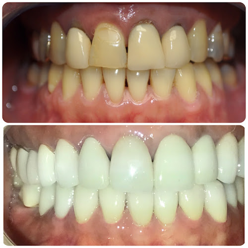 Esthetix Dentist, NYC’s Dental Implant & Cosmetic Specialist