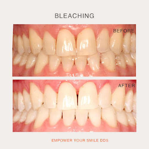 Empower Your Smile DDS