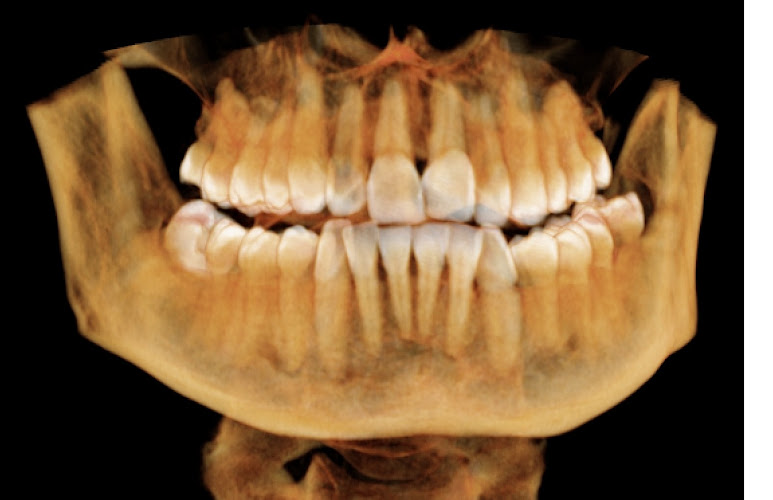 Dr. Zev Kaufman, DDS