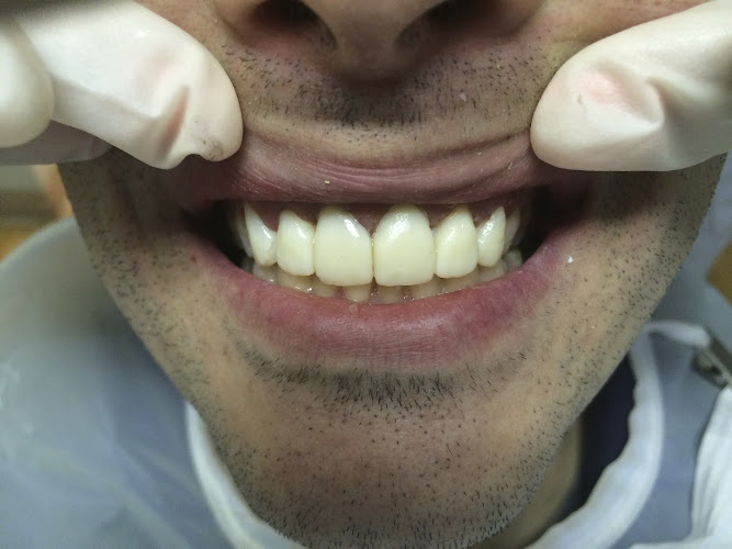 Teeth Cleaning Manhattan New York – Paul L. Gregory, DDS