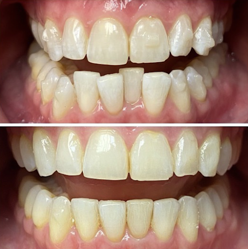 Zen Dentistry – FiDi