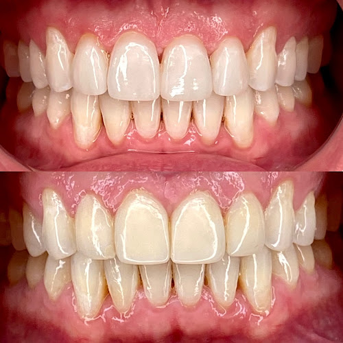 Cosmetic Dentistry Center NYC – Dr. Pia Lieb
